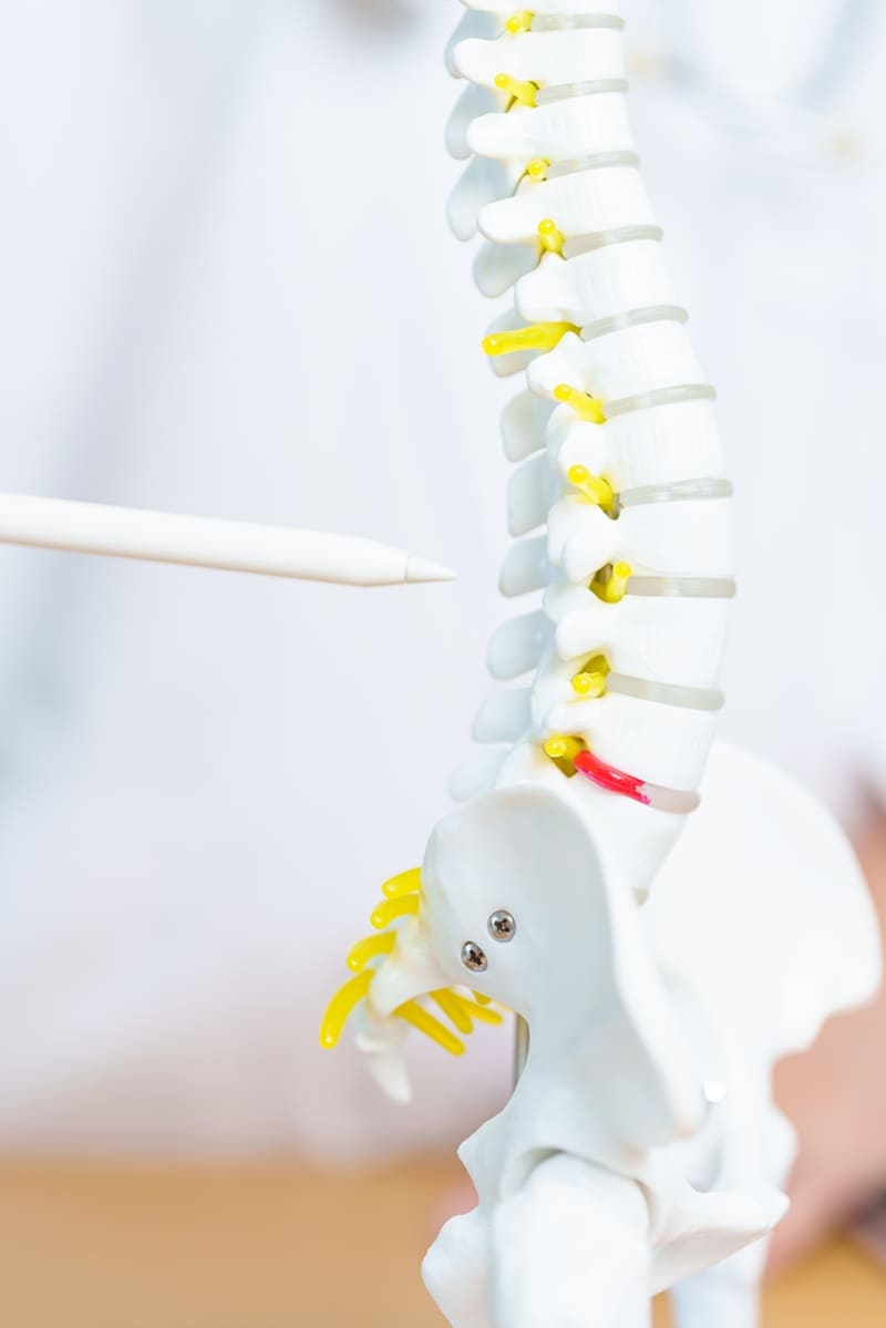 Fisioterapia para hernia discal en Zona Esmeralda